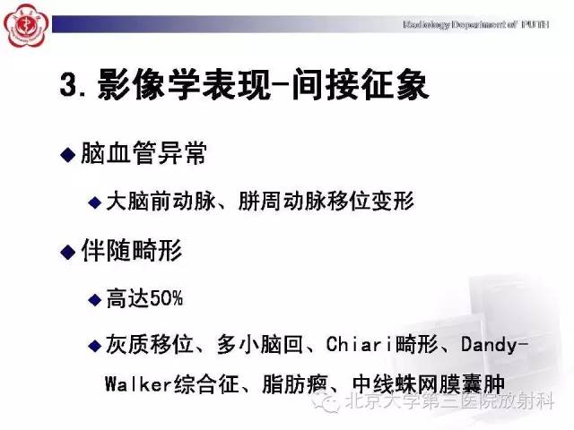 【病例】胎儿胼胝体发育不全1例MR