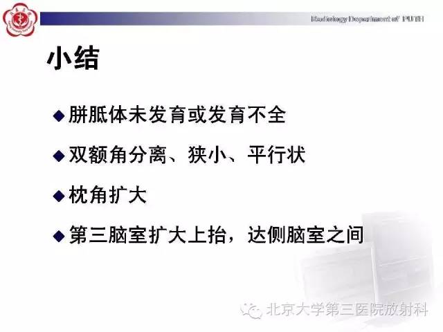 【病例】胎儿胼胝体发育不全1例MR