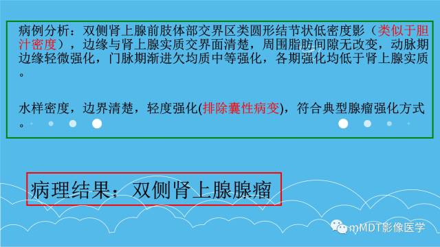 【PPT】双侧肾上腺占位性病变的影像诊断解析