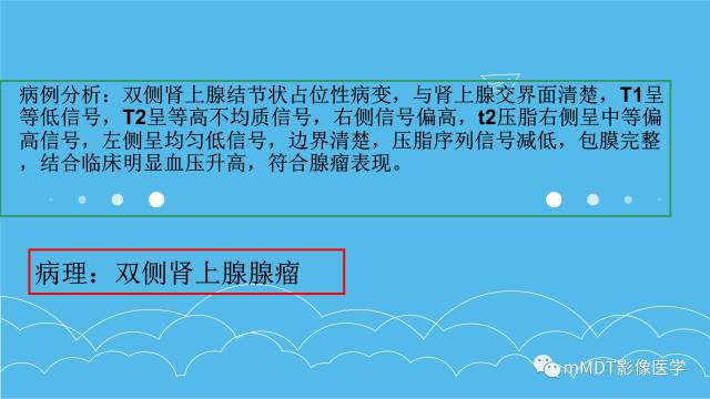 【PPT】双侧肾上腺占位性病变的影像诊断解析