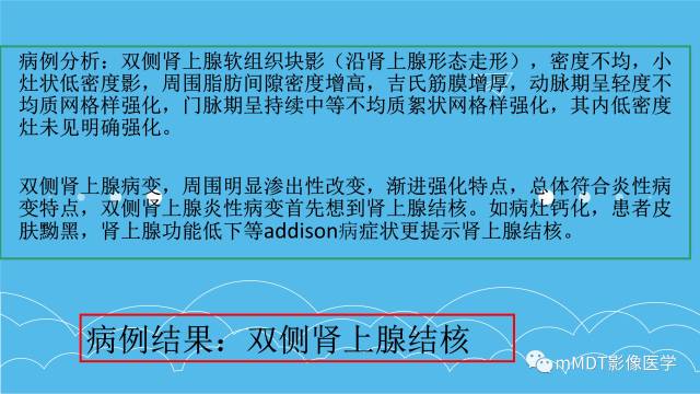 【PPT】双侧肾上腺占位性病变的影像诊断解析
