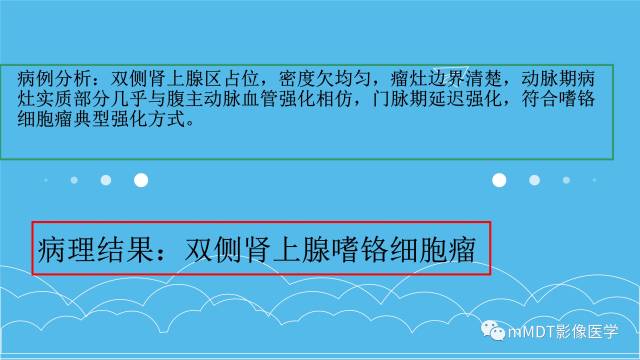 【PPT】双侧肾上腺占位性病变的影像诊断解析