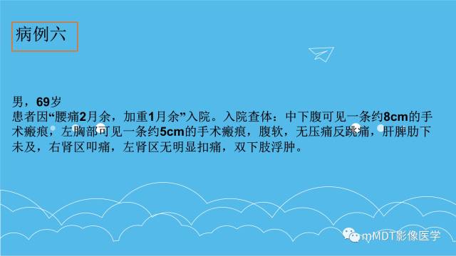 【PPT】双侧肾上腺占位性病变的影像诊断解析