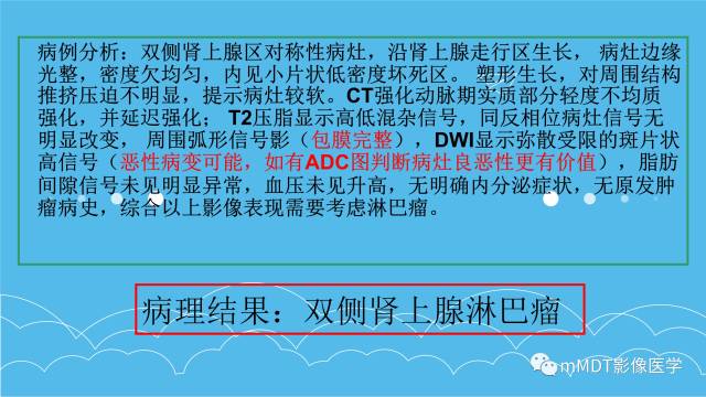 【PPT】双侧肾上腺占位性病变的影像诊断解析