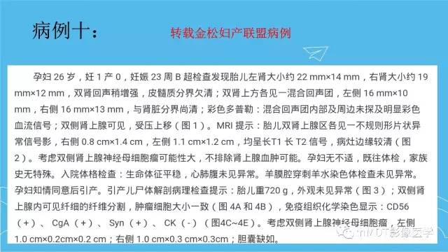 【PPT】双侧肾上腺占位性病变的影像诊断解析