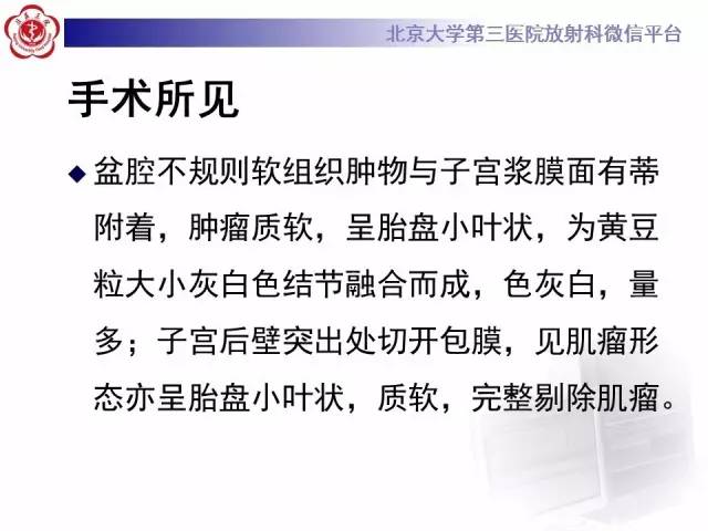 【病例】子宫绒毛叶状分割性平滑肌瘤1例MR