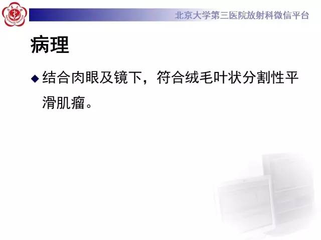 【病例】子宫绒毛叶状分割性平滑肌瘤1例MR