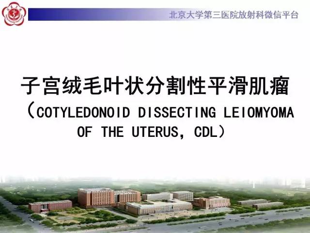 【病例】子宫绒毛叶状分割性平滑肌瘤1例MR