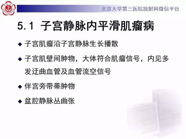 【病例】子宫绒毛叶状分割性平滑肌瘤1例MR