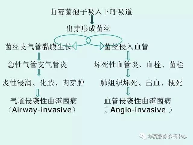 【病例】侵袭性肺曲霉菌病1例CT