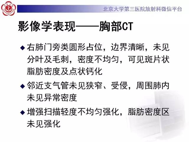 【病例】肺错构瘤1例CT影像表现