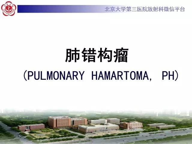 【病例】肺错构瘤1例CT影像表现