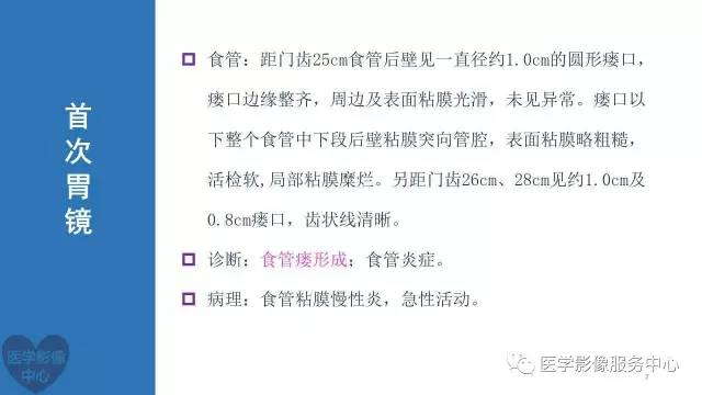【病例】食管重复畸形1例X线CT