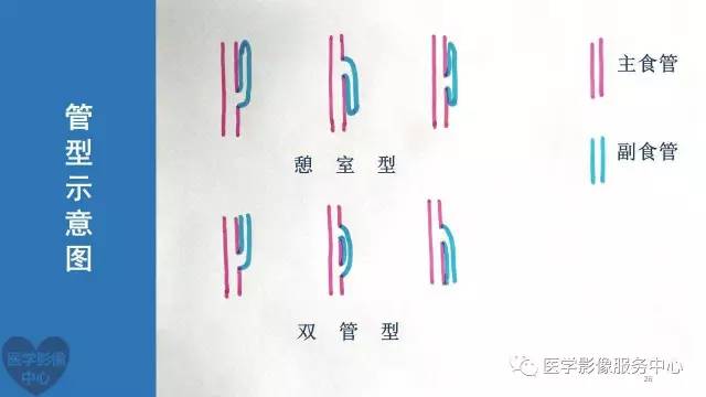 【病例】食管重复畸形1例X线CT