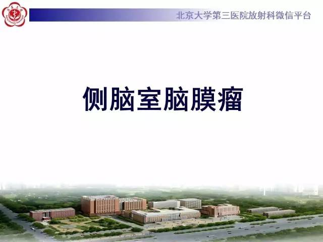 【病例】左侧脑室三角区脑膜瘤1例MR