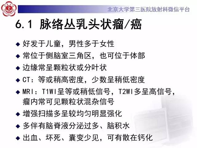 【病例】左侧脑室三角区脑膜瘤1例MR