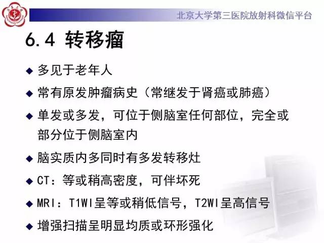 【病例】左侧脑室三角区脑膜瘤1例MR