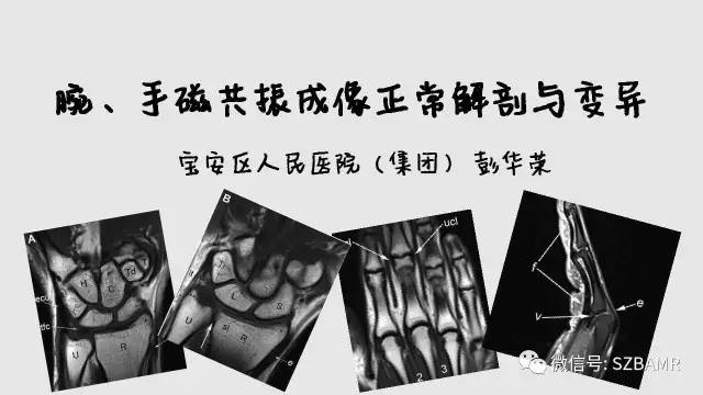 【PPT】腕、手磁共振成像正常解剖与变异