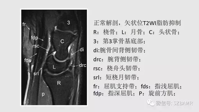 【PPT】腕、手磁共振成像正常解剖与变异