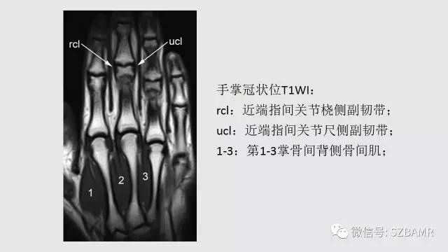 【PPT】腕、手磁共振成像正常解剖与变异