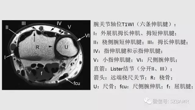 【PPT】腕、手磁共振成像正常解剖与变异