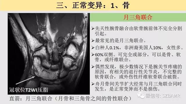 【PPT】腕、手磁共振成像正常解剖与变异