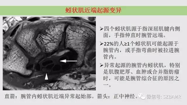 【PPT】腕、手磁共振成像正常解剖与变异
