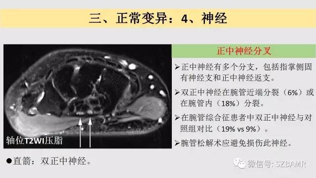 【PPT】腕、手磁共振成像正常解剖与变异