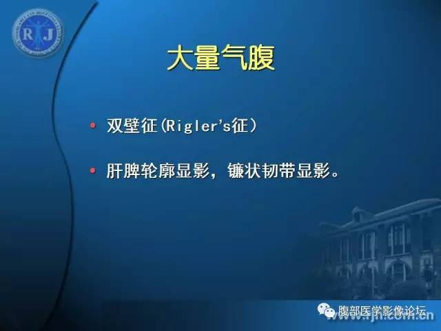 【PPT】 急腹症时的腹腔积气与积液