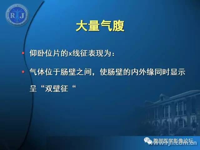 【PPT】 急腹症时的腹腔积气与积液