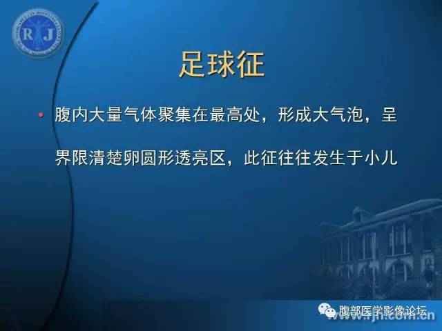 【PPT】 急腹症时的腹腔积气与积液