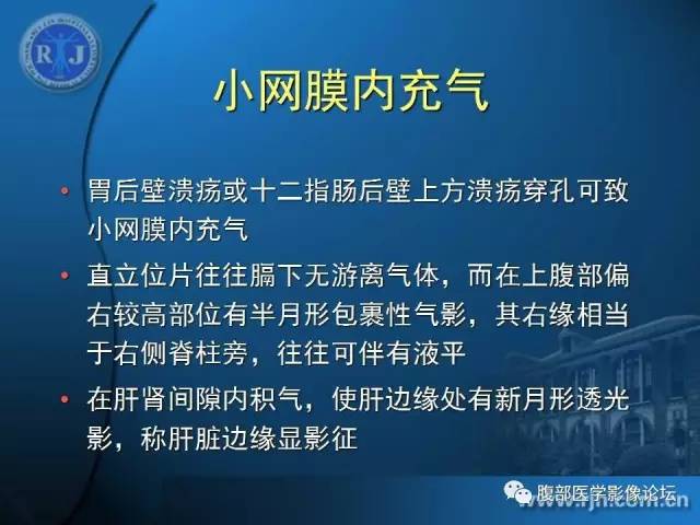 【PPT】 急腹症时的腹腔积气与积液