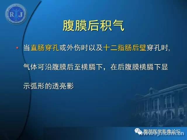 【PPT】 急腹症时的腹腔积气与积液
