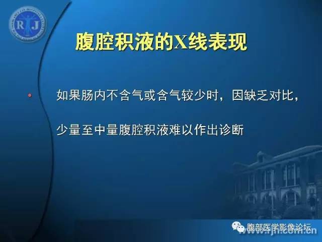 【PPT】 急腹症时的腹腔积气与积液