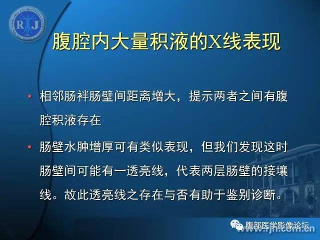 【PPT】 急腹症时的腹腔积气与积液