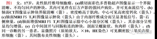 儿童腹膜、网膜及肠系膜实性肿瘤的影像与病理对照 儿童腹膜、网膜及肠系膜实性肿瘤的影像与病理对照