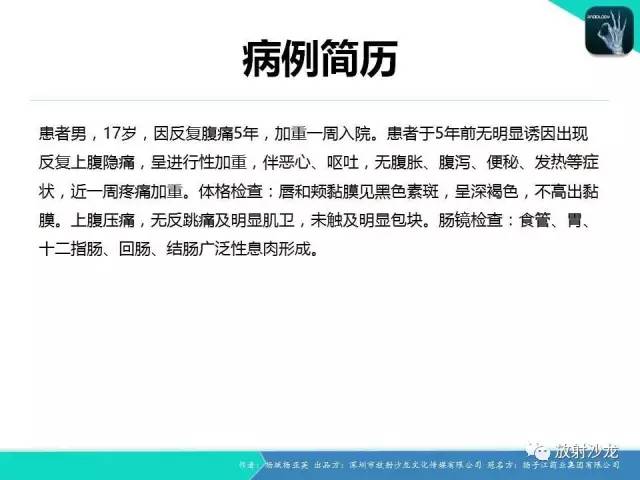 【病例】黑斑息肉病并肠套叠1例CT