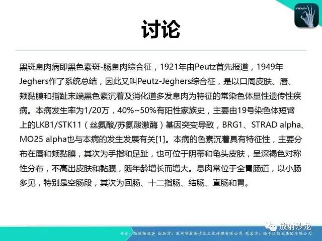 【病例】黑斑息肉病并肠套叠1例CT