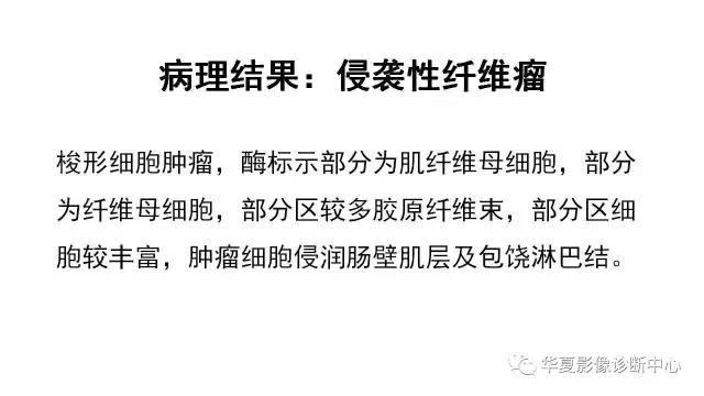 【病例】肠系膜侵袭性纤维瘤1例CT影像表现
