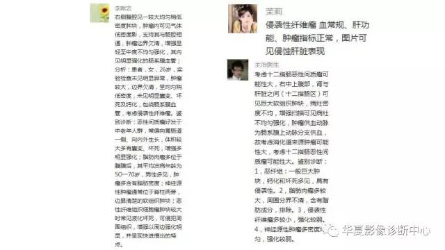 【病例】肠系膜侵袭性纤维瘤1例CT影像表现
