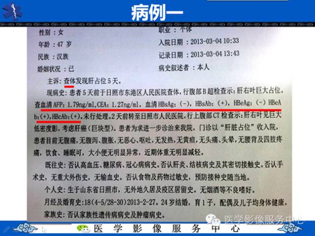 【病例】肝腺瘤2例CT影像表现