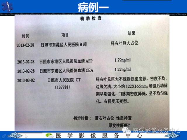 【病例】肝腺瘤2例CT影像表现