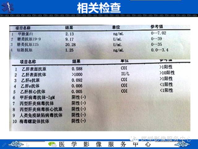 【病例】肝腺瘤2例CT影像表现