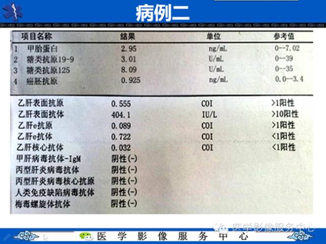 【病例】肝腺瘤2例CT影像表现