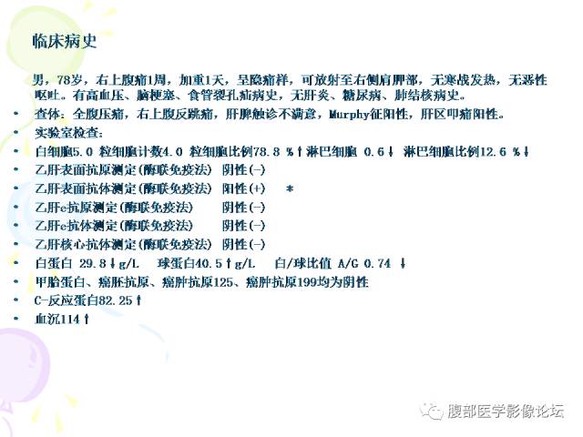 【病例】肝脏多发结核1例CT影像表现 【病例】肝脏多发结核1例CT影像表现