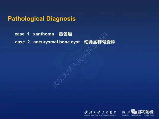【PPT】骨原发性黄色瘤影像诊断