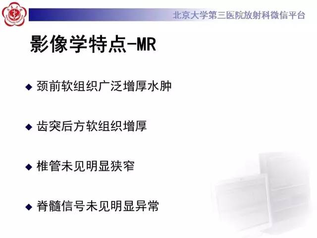【病例】寰椎爆裂性骨折1例CT及MR
