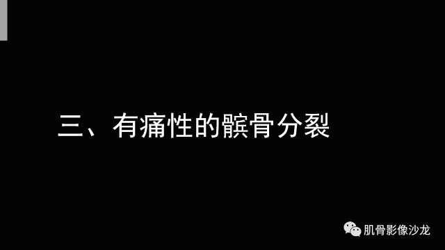 【PPT】年轻人膝关节的几个疾病