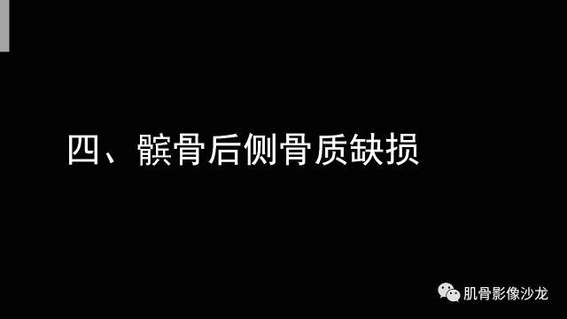 【PPT】年轻人膝关节的几个疾病