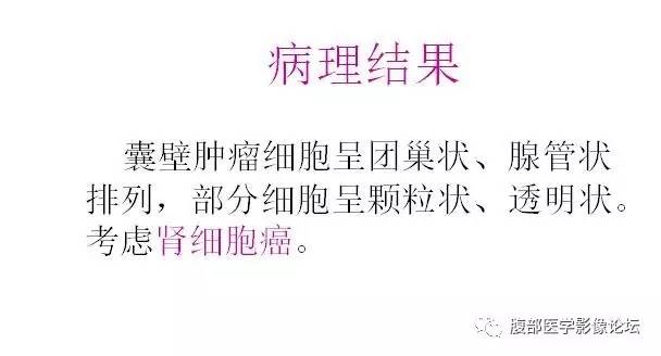【病例】囊性肾癌1例CT影像表现